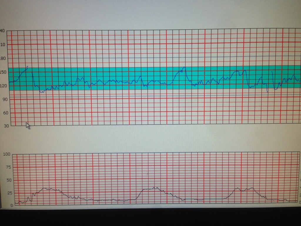 Contraction Monitor